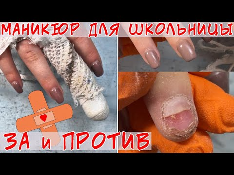 Видео: Сломала ноготь на физкультуре 😯😳 Ноготь выгнулся в обратную сторону
