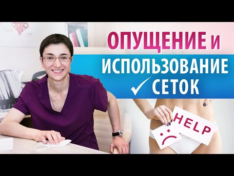 Видео: Опущение стенок влагалища и матки: все плюсы и минусы сетчатых имплантов