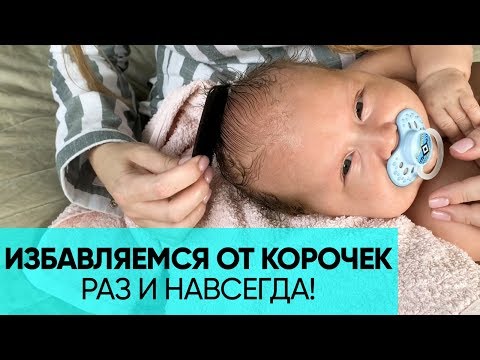Видео: КАК УБРАТЬ КОРОЧКИ НА ГОЛОВЕ У МАЛЫША? Пошаговая инструкция для родителей. Ника Болзан