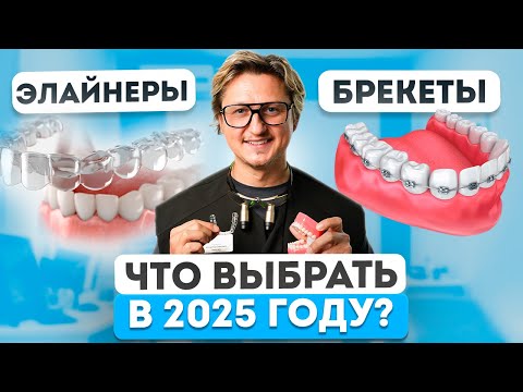Видео: Брекеты или элайнеры? ВСЁ, что НУЖНО знать перед установкой в этом ролике!
