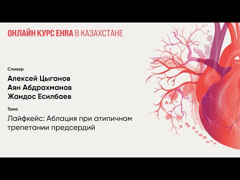 Видео: Лайфкейс: Аблация при атипичном трепетании предсердий