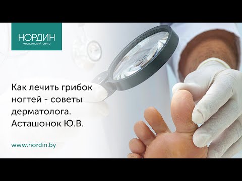 Видео: Как лечить грибок ногтей - советы дерматолога