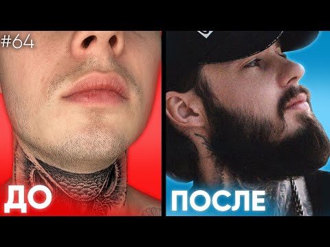 Видео: Результат ксиноксина и mr.Volos для роста бороды / Полный отчёт за 5 месяцев