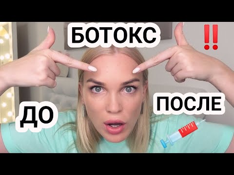 Видео: ❌НЕ КОЛИТЕ БОТОКС❌ПОКА НЕ ПОСМОТРИТЕ ЭТО ВИДЕО️✅ДО/ ПОСЛЕ #SilenaSway_Силена Вселенная
