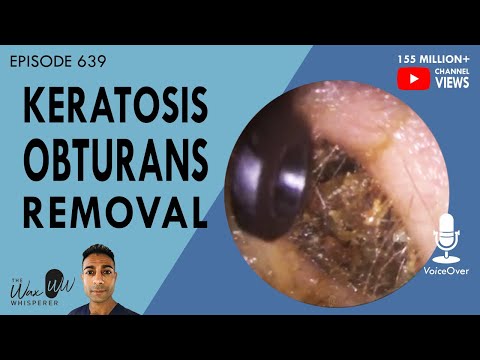 Видео: 639 - Удаление обтурирующего кератоза