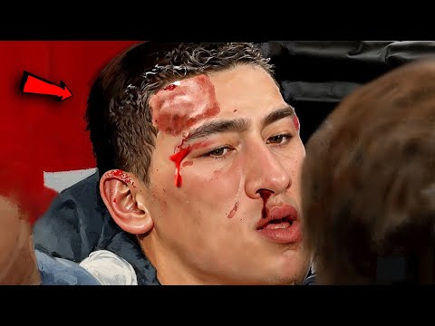 Видео: Это Нечто! Бой Где Дмитрий Бивол Был на Грани😨