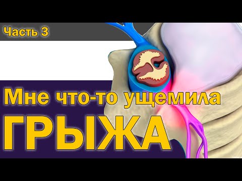 Видео: Защемило нерв. Грыжа диска: Часть 3 [S04E04]