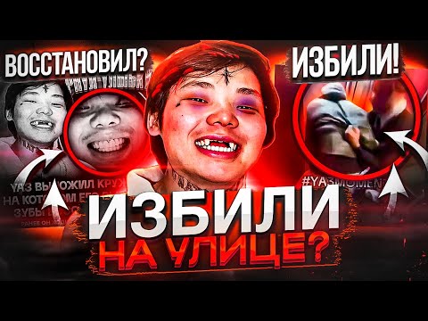 Видео: YA3 ВЫБИЛИ ЗУБЫ! ЧТО СЛУЧИЛОСЬ? / ФАНЫ ТЕХНИКА ПРОТИВ ЦОЯ / ДАРЬЯНА, BABY MELO & ЭВЕЛОН