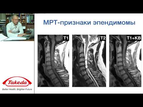 Видео: Лекция "Интрамедуллярные опухоли"