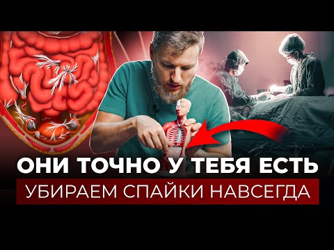 Видео: СПАЙКИ – как убрать навсегда?