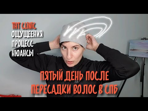 Видео: АЛОПЕЦИЯ Пересадка волос женщинам в СПБ| THT clinic | ПЯТЫЙ день после трансплантации|январь 2023 г.