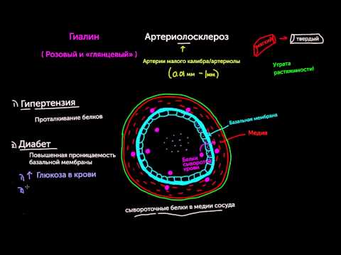 Видео: Артериолосклероз, часть 1