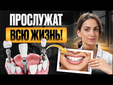 Видео: Вся ПРАВДА об имплантации за 13 минут! / Какие зубные имплантаты прослужат ДОЛГО?