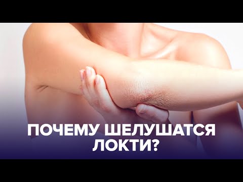 Видео: Шершавые ЛОКТИ: о каких болезнях они могут рассказать?