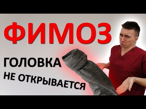 Видео: Как избавиться от ФИМОЗА. Растягивать крайнюю плоть ОПАСНО. Самая ЛУЧШАЯ инструкция в интернете