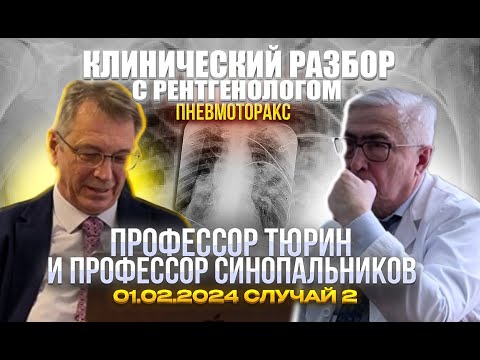 Видео: Клинический разбор с рентгенологом. Профессор Тюрин. Пневмоторакс. Разбор 01.02.2024 случай 2.