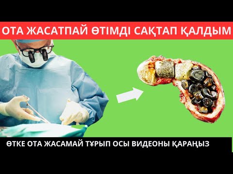 Видео: ӨТТЕГІ ТАСТЫ ОТАМЕН АЛАМ ДЕДІ БІРАҚ МЕН ВИДЕО ҚАРАП САҚТАП ҚАЛДЫМ оттеги тасты калай кетируге болады