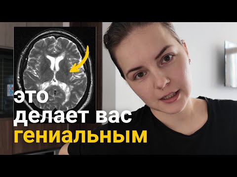 Видео: Как натренировать гениальность? Простой способ