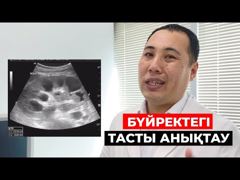 Видео: Бүйректегі тасты қалай анықтаймыз! Бүйрек ауруы!  Бүйрек емін анықтау! УЗИ аппараты