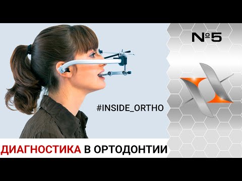 Видео: Правильная ДИАГНОСТИКА и ПЛАНИРОВАНИЕ ортодонтического лечения (мини-семинар, ортодонтия)