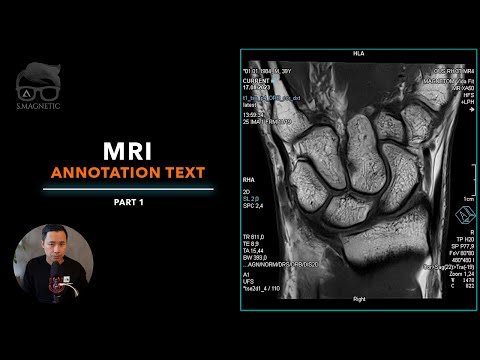 Видео: 🧠 МРТ – Текст аннотации – Часть 1
