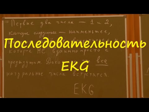 Видео: М1863. Последовательность EKG