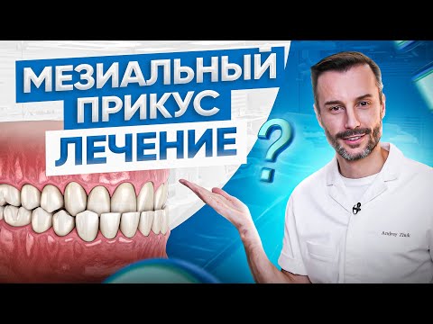 Видео: Виды неправильного прикуса у человека #3 | Мезиальный прикус