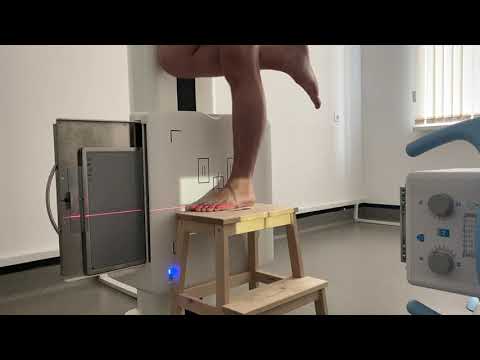 Видео: Укладка стопы с нагрузкой