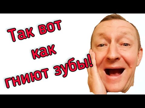 Видео: So this is how teeth rot! Так вот как гниют зубы!