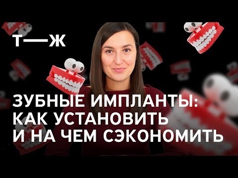 Видео: Зубные импланты: сколько стоит установка, как сэкономить