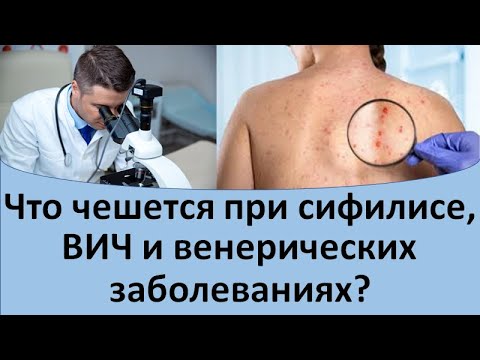 Видео: Что чешется при сифилисе, вич и иппп