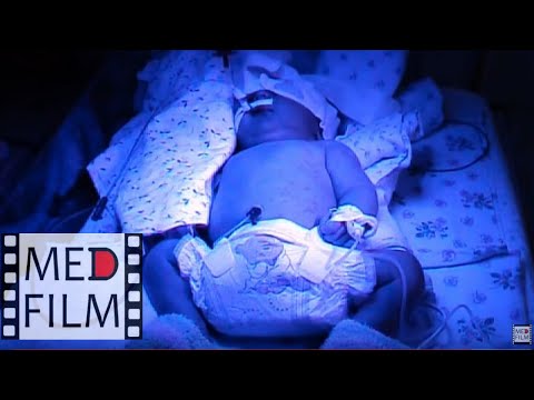 Видео: Недоношенный ребенок. Реанимация © Intensive care unit of the maternity hospital