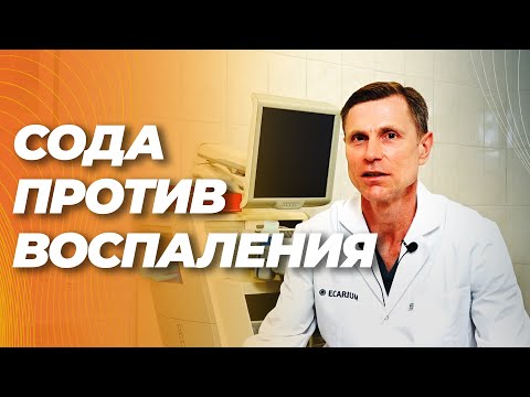 Видео: Сода против хронического воспаления, аутоиммунных болезней, атеросклероза, старения и даже диабета.