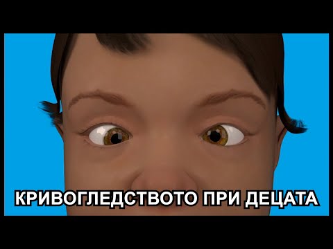 Видео: Кривогледство в детска възраст