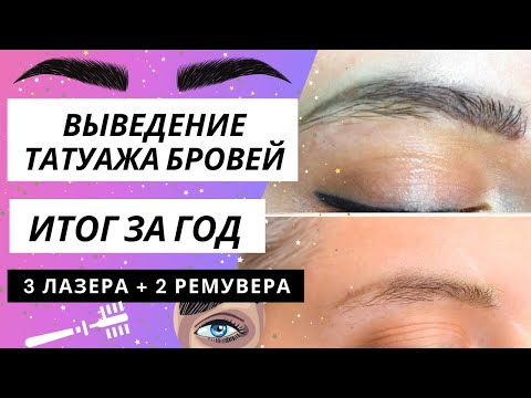 Видео: ВЫВЕДЕНИЕ ТАТУАЖА БРОВЕЙ || Лазер + ремувер || Итог за год || Ожидания - реальность