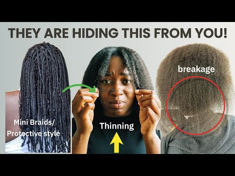 Видео: Опасность мини-косичек/Защитные стили, которые они от вас скрывают | Смотрите, как B4 u делает ми...
