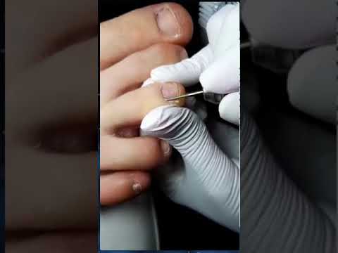 Видео: 09 Эстетический педикюр Подомарафон