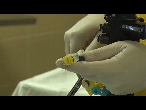 Видео: Эндоскопическое лигирование ВРВП, клинический случай №3, МКНЦ 23.01.19