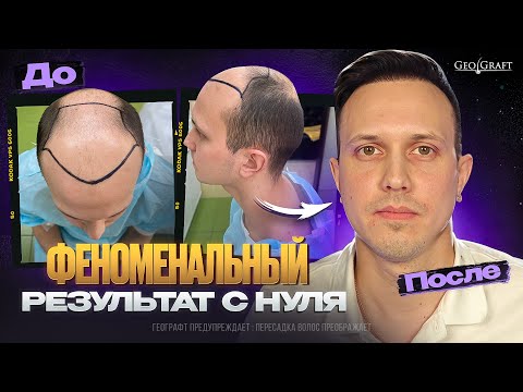 Видео: Феноменальный результат - новая жизнь, Географт