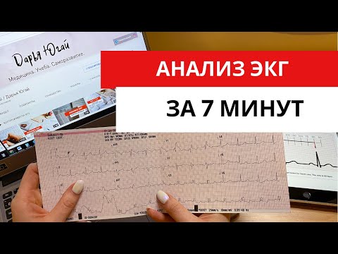 Видео: Научись анализировать ЭКГ за 7 минут!!! (Подробный разбор ЭКГ).