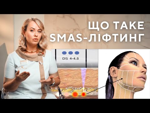 Видео: СМАС-ліфтинг - що це?