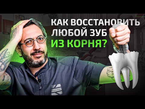 Видео: Как лучше всего восстановить зуб, если остался только корень