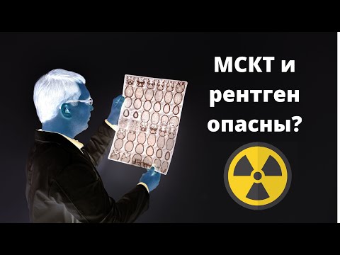 Видео: Опасны ли МСКТ и рентген?