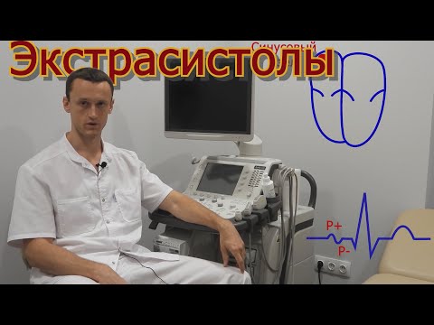 Видео: Экстрасистолия (экстрасистолы).