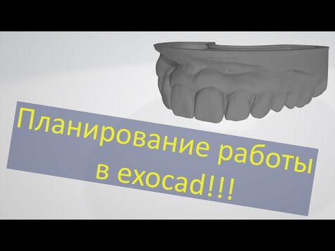 Видео: Планирование протезирования. Живая работа, моделировка зубов waxup в exocad. Для спонсоров канала