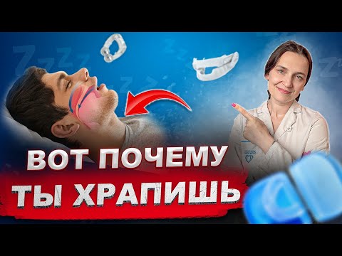 Видео: ВЫЛЕЧИТЬ ХРАП НАВСЕГДА - МОЖНО И НУЖНО |  Все о причинах и лечении храпа