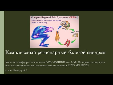 Видео: Комплексный регионарный болевой синдром