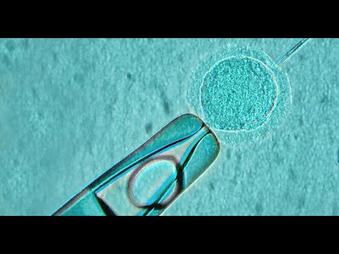 Видео: ЭКО. Дінде жасанды жолмен бала көтеру жайында / А. Қасым