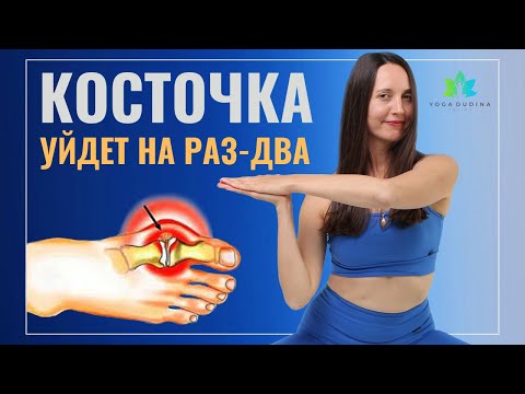 Видео: КОСТОЧКА на ноге. 2 ПРИЧИНЫ и УПРАЖНЕНИЯ для самостоятельного ЛЕЧЕНИЯ