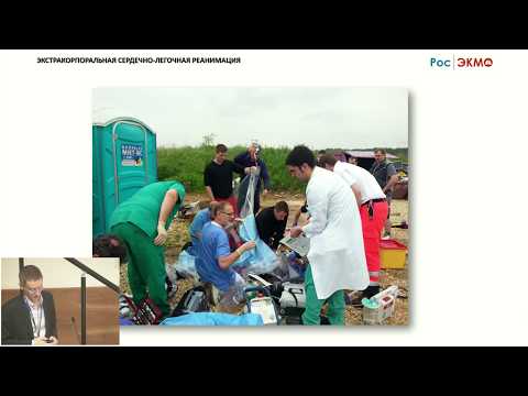 Видео: Экстракорпоральная сердечно-легочная реанимация